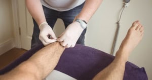 Склеротерапія – ефективне рішення для видалення венозної сіточки
